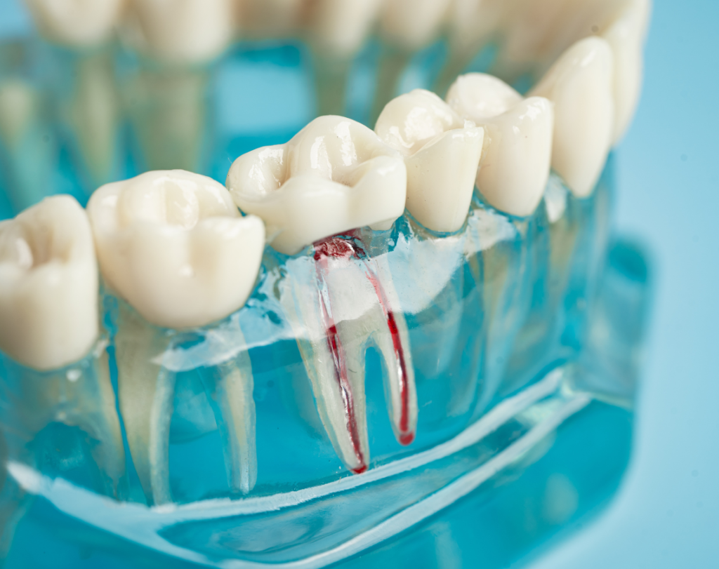 root canal specialist near me, root canal treatment near me