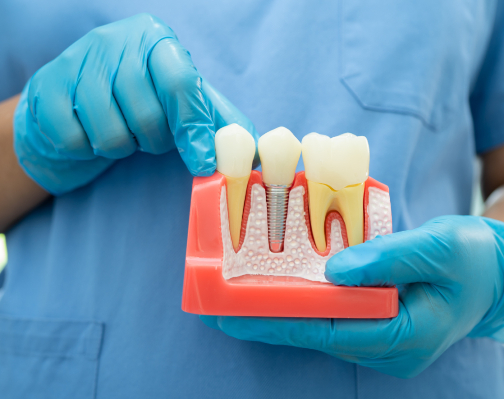 root canal cost in nashik