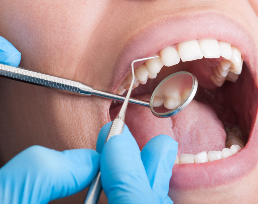 teeth cleaning near me, teeth clinic near me
