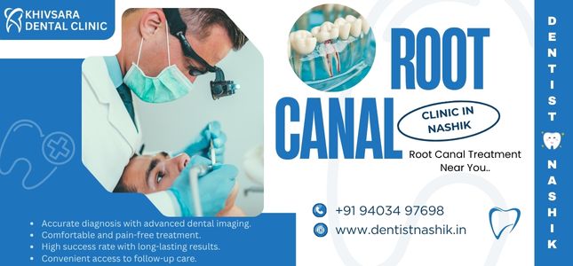 Root Canal Treatment in Nashik, root canal clinic in nashik, root canal cost in nashik, root canal specialist near me, root canal treatment near me,